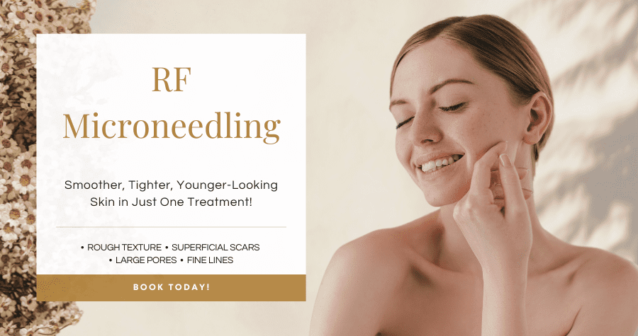 RF Microneedling services