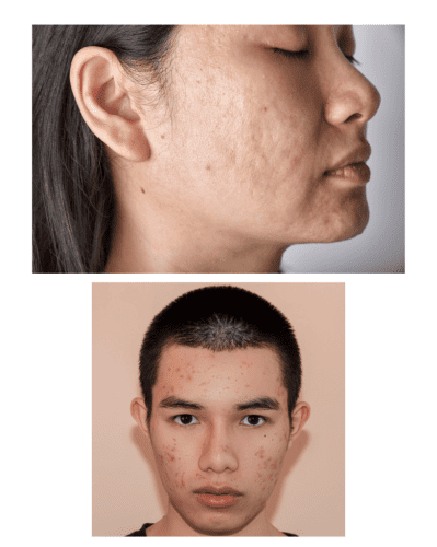 1 Skincare treatments