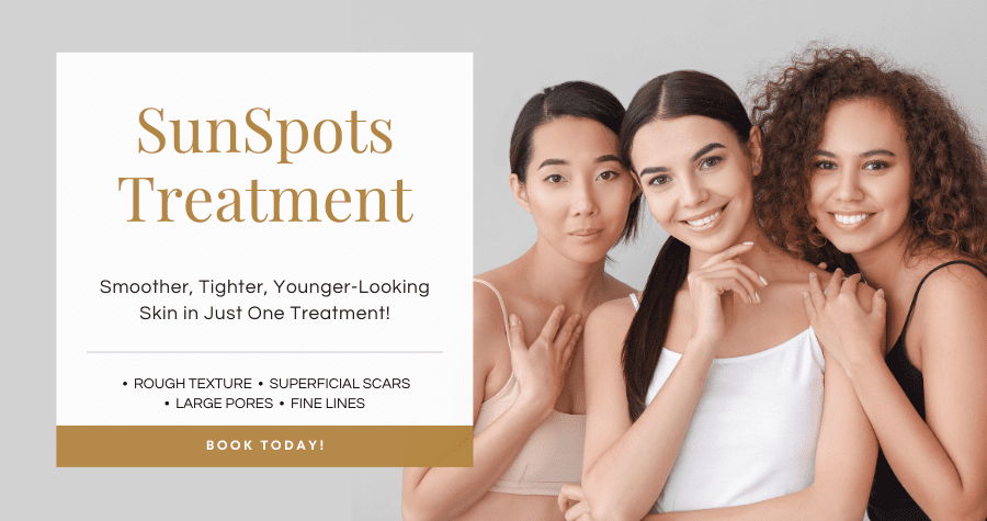 Sun Spot treatment Sun Spot treatment