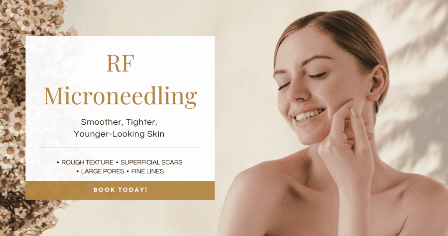 RF Microneedling services