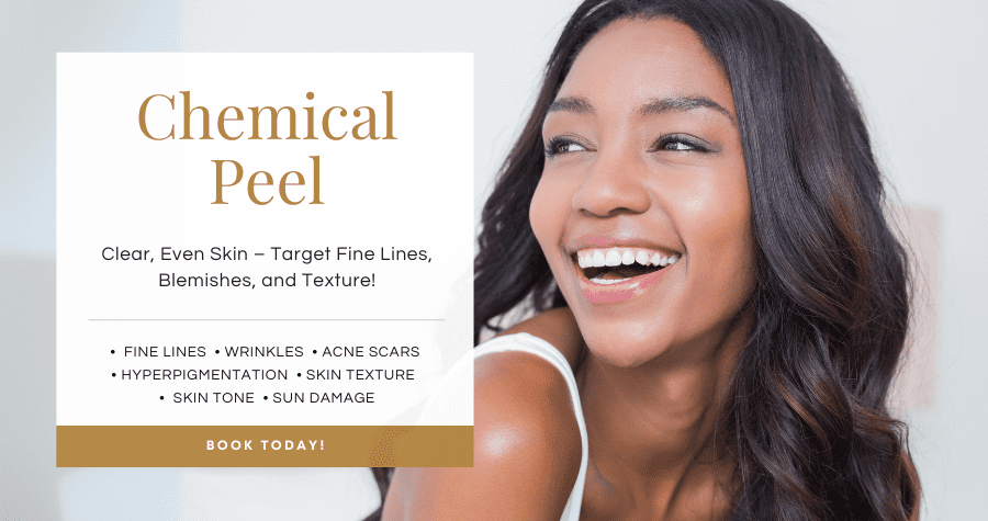 Chemical peels Chemical peels services