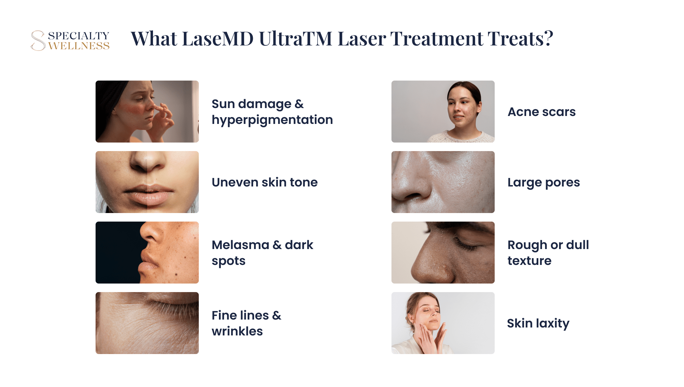 What LaseMD UltraTM Laser Treatment Treats__